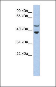 Anti-SOCS7, (N-terminal) antibody produced in rabbit affinity isolated antibody