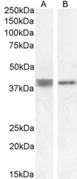 Anti-ATP6IP2/Renin Receptor antibody produced in goat affinity isolated antibody, buffered aqueous solution