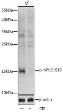 Anti-Phospho-MYL9-S19 antibody produced in rabbit