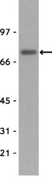 Anti-ZAP-70 Antibody, clone 2F3.2 clone 2F3.2, Upstate&#174;, from mouse