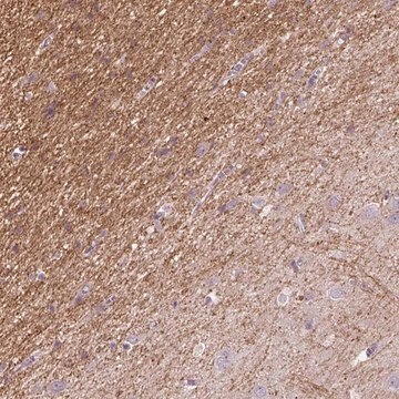 Anty-KCNIP3 Prestige Antibodies&#174; Powered by Atlas Antibodies, affinity isolated antibody