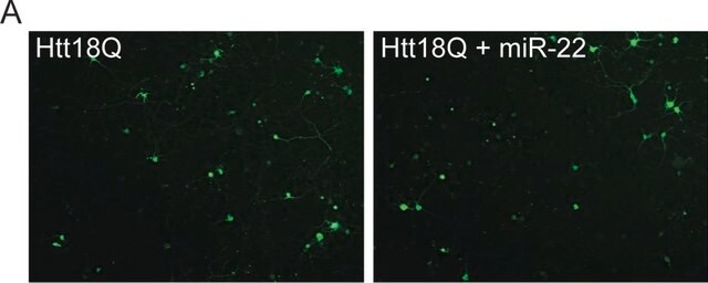 Anti-Huntingtin-Antikörper, A.S. 1-82 ascites fluid, clone 2B4, Chemicon&#174;