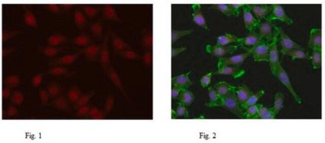 Anti-TIF1-alpha Antibody from rabbit, purified by affinity chromatography