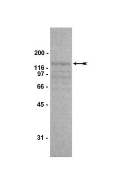 Abl Protein, active, mouse, 10 &#181;g Active, recombinant mouse Abl, residues 27-1123, containing N-terminal His-6 tag, for use in Kinase Assays.