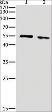 Anti-pan-AKT antibody produced in rabbit affinity isolated antibody