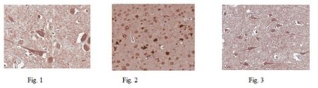 Anticorps anti-GluR2 from rabbit, purified by affinity chromatography