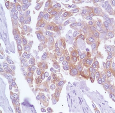 Anti-TAU antibody, Rabbit monoclonal recombinant, expressed in proprietary host, clone SP70, affinity isolated antibody