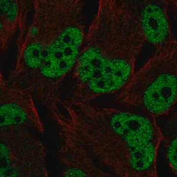 Anti-Esr2 Antibody Produced In Rabbit Prestige Antibodies&#174; Powered by Atlas Antibodies, affinity isolated antibody, buffered aqueous glycerol solution