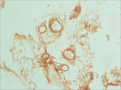 Anti-Podoplanin antibody produced in rabbit ~1&#160;mg/mL, affinity isolated antibody, buffered aqueous solution