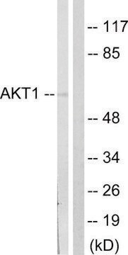 抗-AKT 兔抗 affinity isolated antibody