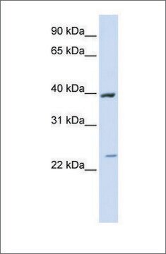 抗ACADL抗体 ウサギ宿主抗体 affinity isolated antibody