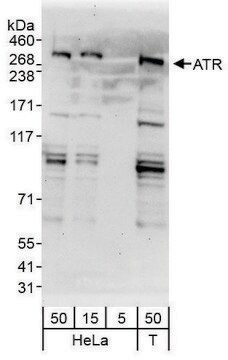 Rabbit anti-ATR Antibody, Affinity Purified Powered by Bethyl Laboratories, Inc.