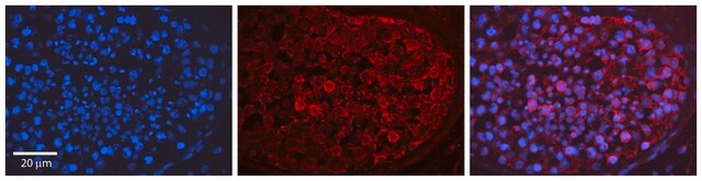 Anti-MAPK1 (C-terminal) antibody produced in rabbit affinity isolated antibody