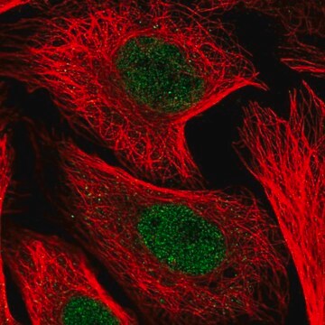 Anty-KDELC1 Prestige Antibodies&#174; Powered by Atlas Antibodies, affinity isolated antibody