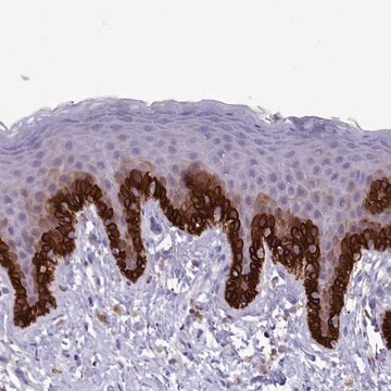 Anti-RAC1 antibody produced in rabbit Prestige Antibodies&#174; Powered by Atlas Antibodies, affinity isolated antibody, buffered aqueous glycerol solution