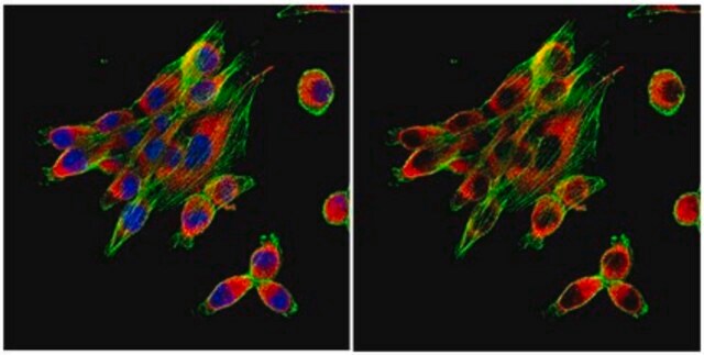 Anticorpo anti-calnexina from rabbit, purified by affinity chromatography