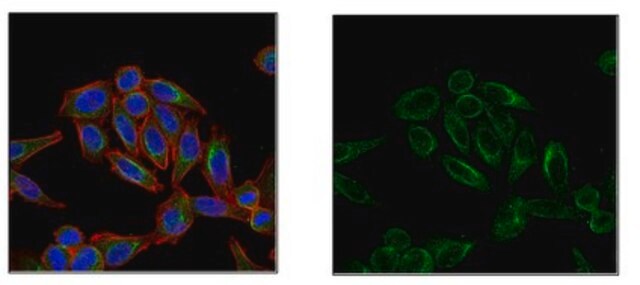 Anti-Folliculin (FLCN), Antibody clone 8D9.2 clone 8D9.2, from mouse