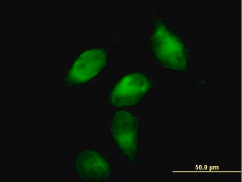 Anti-SERPINA3 antibody produced in mouse purified immunoglobulin, buffered aqueous solution