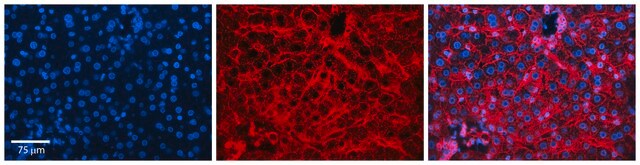 Anti-CD81 (C-terminal) antibody produced in rabbit affinity isolated antibody