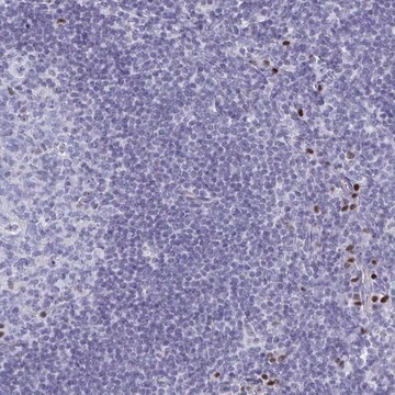 Anti-SLC25A51 antibody produced in rabbit Prestige Antibodies&#174; Powered by Atlas Antibodies, affinity isolated antibody, buffered aqueous glycerol solution