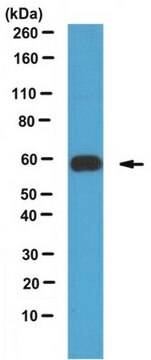 Anti-IGPR-1 Antibody 1&#160;mg/mL, from rabbit