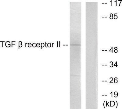 Anti-TGF &#946; Receptor II antibody produced in rabbit affinity isolated antibody