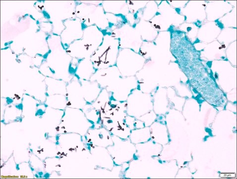 Grzyby 2863 Szkiełka kontrolne from mouse lung containing Candida albicans