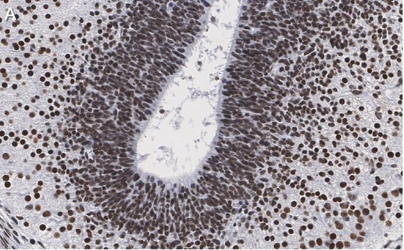 Anti-LMX-1 Antibody, clone 4L12, ZooMAb&#174; Rabbit Monoclonal recombinant, expressed in HEK 293 cells