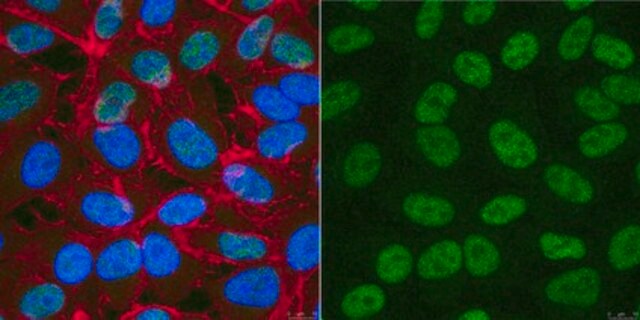 Anti-XPD Antibody, clone 22TF2-2F6 clone 22TF2-2F6, from mouse