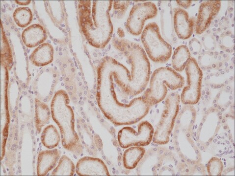 Anti-p504s/AMACR antibody, Rabbit monoclonal recombinant, expressed in HEK 293 cells, clone RM349, purified immunoglobulin