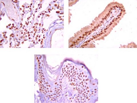 Anticorpo anti-Na+/K+ ATPasi &#945;-1 Upstate&#174;, from rabbit