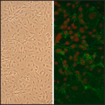 Human Subclavian Artery Endothelial Cells: HScAEC, adult