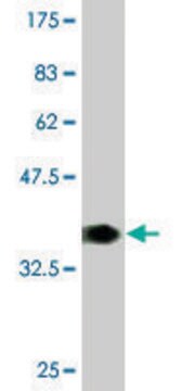 Monoclonal Anti-FMR1 antibody produced in mouse clone 3E11, purified immunoglobulin, buffered aqueous solution