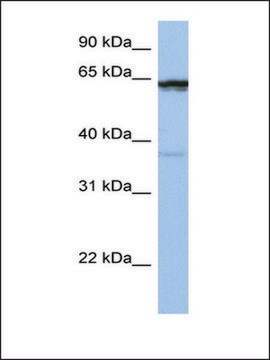 Anti-POPDC2 antibody produced in rabbit affinity isolated antibody