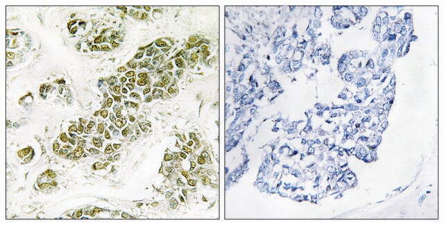 Anti-EIF2 &#945; antibody produced in rabbit affinity isolated antibody