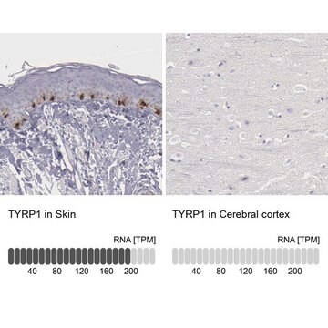 Anti-TYRP1 antibody produced in rabbit Prestige Antibodies&#174; Powered by Atlas Antibodies, affinity isolated antibody, buffered aqueous glycerol solution