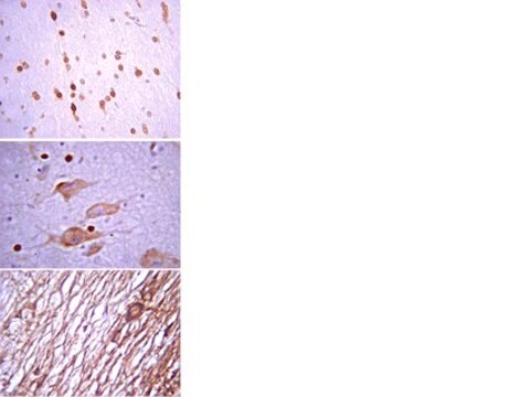 Anti-Vesicular GABA Transporter Antibody serum, from rabbit