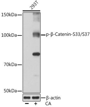 Anti-Phospho-&#946;-Catenin-S33/S37 antibody produced in rabbit