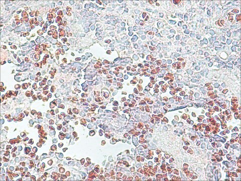 Anti-Histone Deacetylase 2 (HDAC2) antibody produced in rabbit IgG fraction of antiserum, buffered aqueous solution