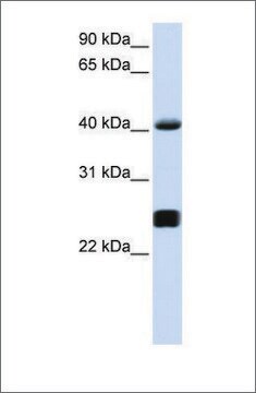 Anti-SERPINA3 antibody produced in rabbit affinity isolated antibody