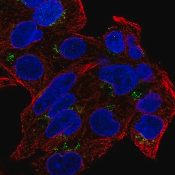 Anty-GDPD5 Prestige Antibodies&#174; Powered by Atlas Antibodies, affinity isolated antibody