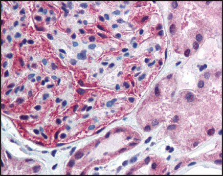 Anti-FANCF antibody produced in rabbit affinity isolated antibody, buffered aqueous solution