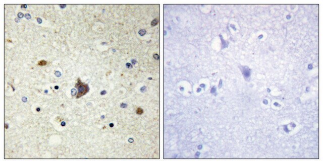 Anti-Collagen IV &#945;3 antibody produced in rabbit affinity isolated antibody