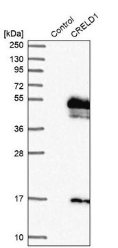 Anti-CRELD1 antibody produced in rabbit Prestige Antibodies&#174; Powered by Atlas Antibodies, affinity isolated antibody, buffered aqueous glycerol solution