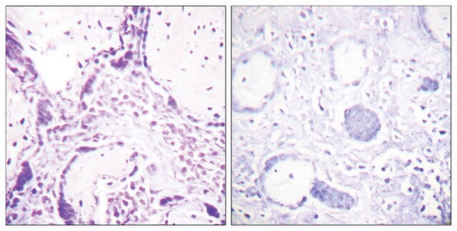 抗 PPAR-&#947; 兔抗 affinity isolated antibody