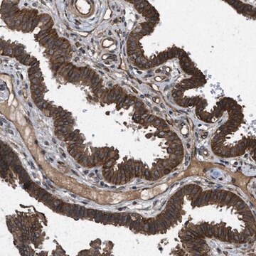 Anti-FZD6 antibody produced in rabbit Prestige Antibodies&#174; Powered by Atlas Antibodies, affinity isolated antibody, buffered aqueous glycerol solution