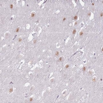 Anti-PTCHD1 antibody produced in rabbit Prestige Antibodies&#174; Powered by Atlas Antibodies, affinity isolated antibody, buffered aqueous glycerol solution