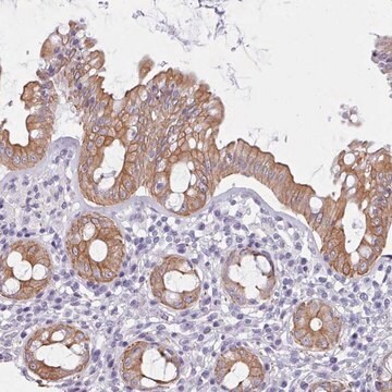 Anti-FPGS antibody produced in rabbit Prestige Antibodies&#174; Powered by Atlas Antibodies, affinity isolated antibody, buffered aqueous glycerol solution