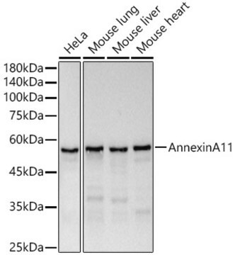 Anti-Annexin A11 Antibody, clone 8O5Z5, Rabbit Monoclonal