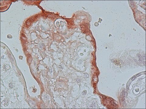 Anti-Fibroblasten-Wachstumsfaktor-Rezeptor&nbsp;3, zytoplasmisch in Kaninchen hergestellte Antikörper affinity isolated antibody, buffered aqueous solution